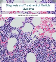 Diagnosis and Treatment of Multiple Myeloma